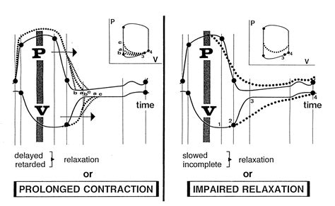 impaired left ventricular relaxation symptoms.